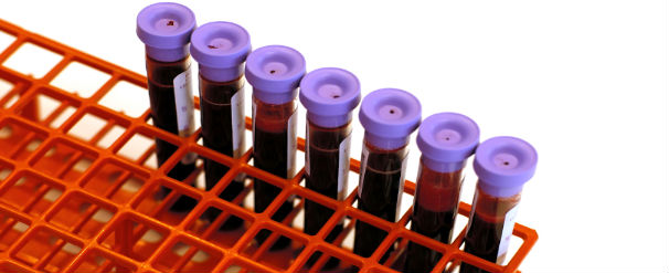 horse blood samples